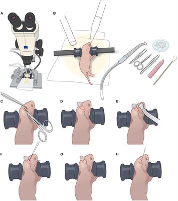 A Versatile Method for Viral Transfection of Calcium Indicators in the Neonatal Mouse Brain